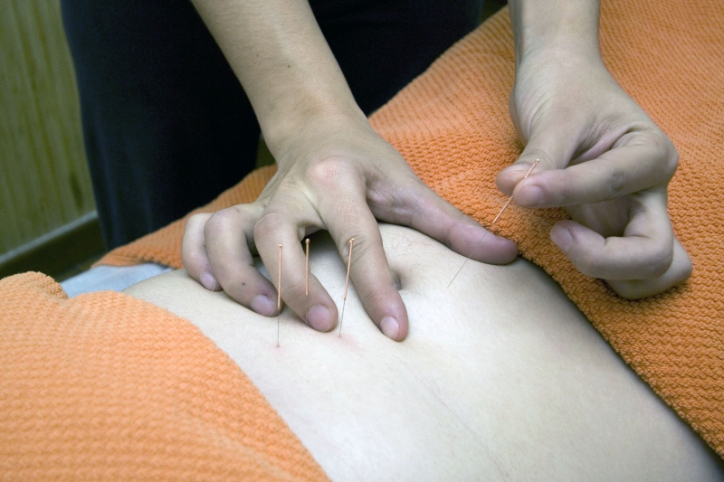 osteopathe-AUPS-min_acupuncture-4175625